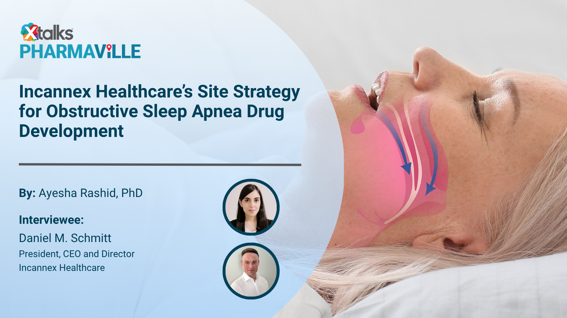 obstructive sleep apnea drug development